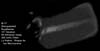 � M. D�hne; Messier 17