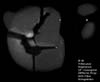 � M. D�hne; Messier 20