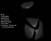� M. D�hne; Messier 20