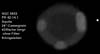 � M. D�hne; NGC 6852
