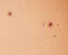 � S. Bergthal; Sonne, 15.08.2000